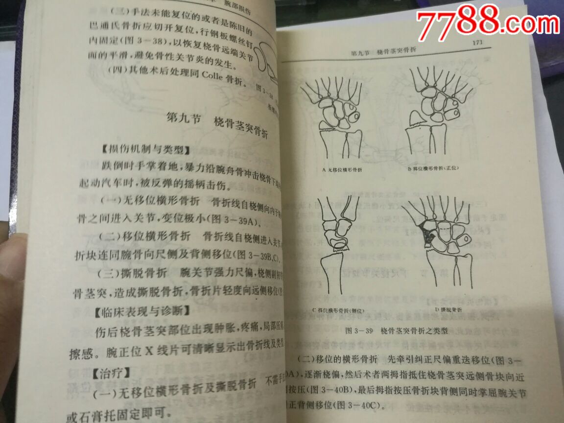 【正骨图解】邱红明,山东科学技术出版社1996印