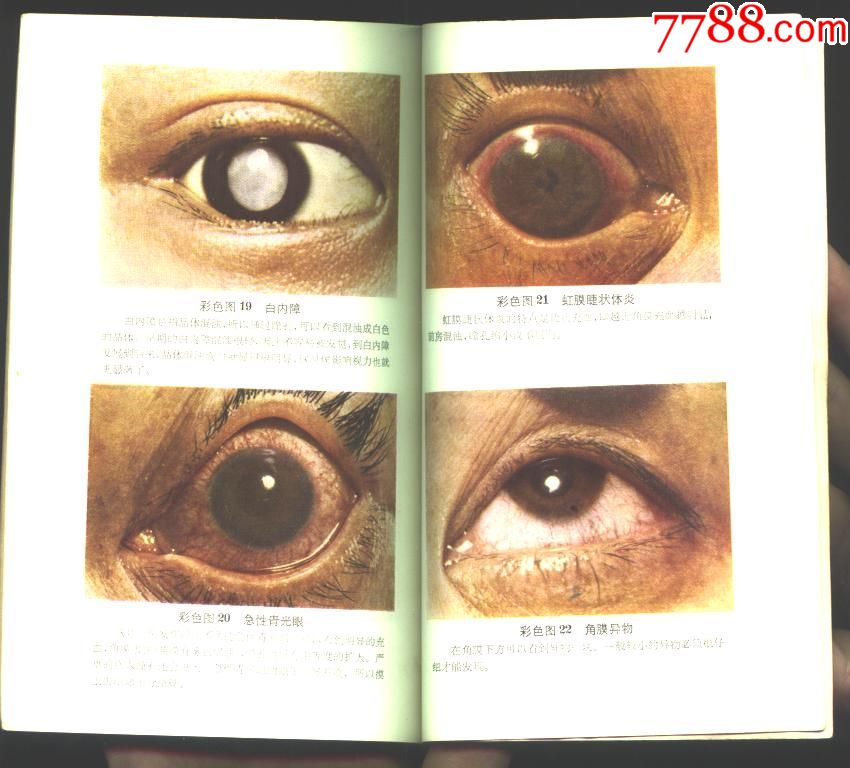 常见眼病的防治[彩色图片]