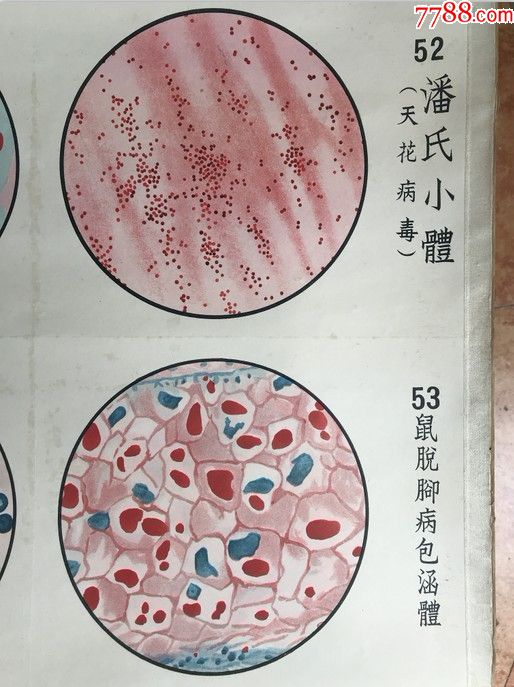 细菌学图谱--葛氏包涵体等