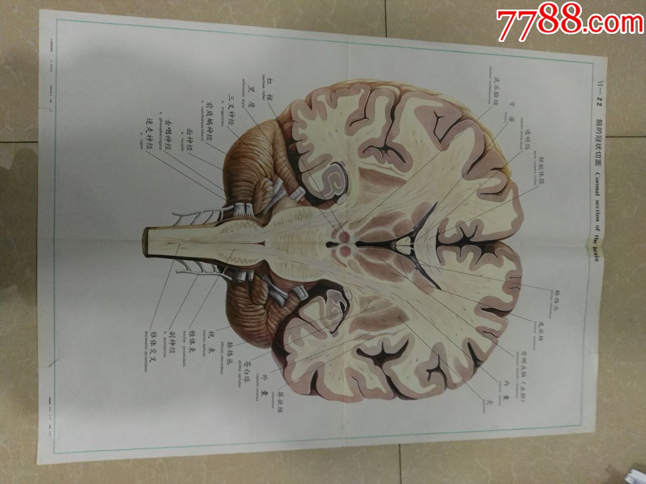 全开人体解剖挂图-脑的冠状切面-中国医科大学出品