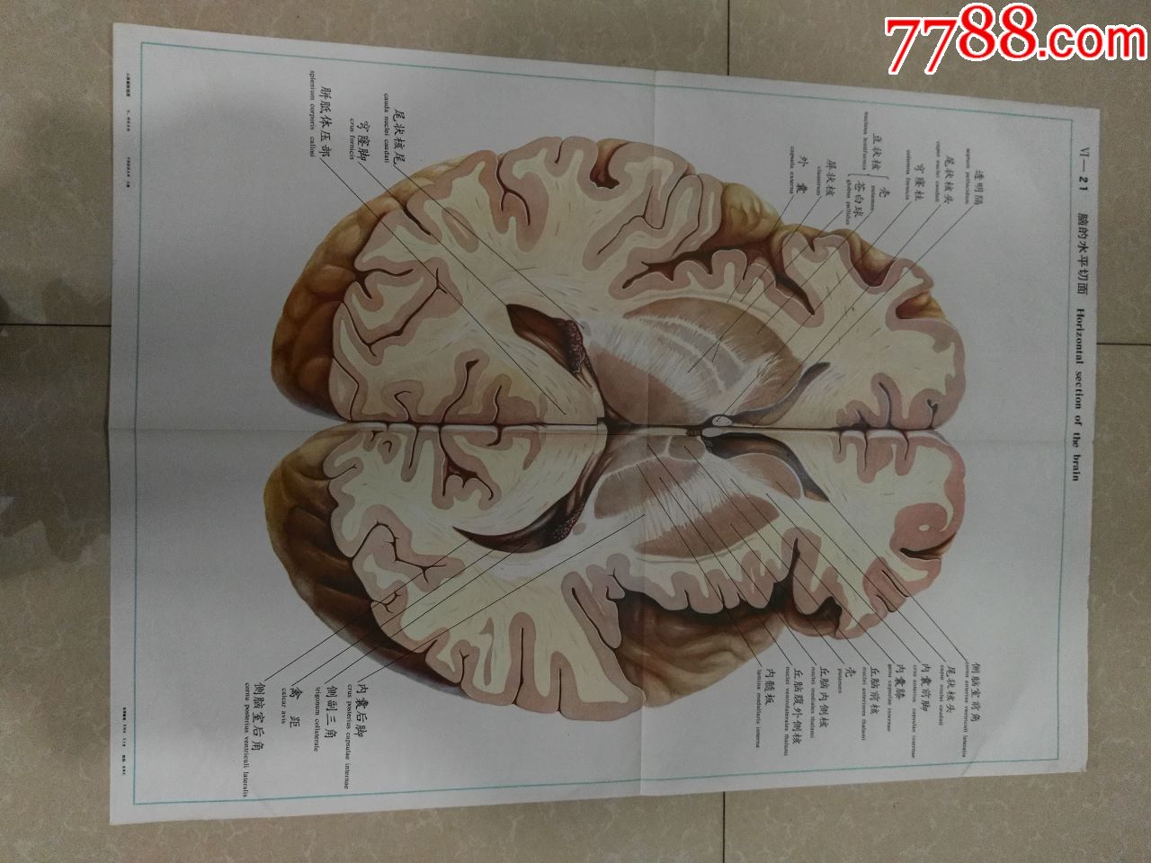 全开人体解剖挂图脑的水平切面中国医科大学出品