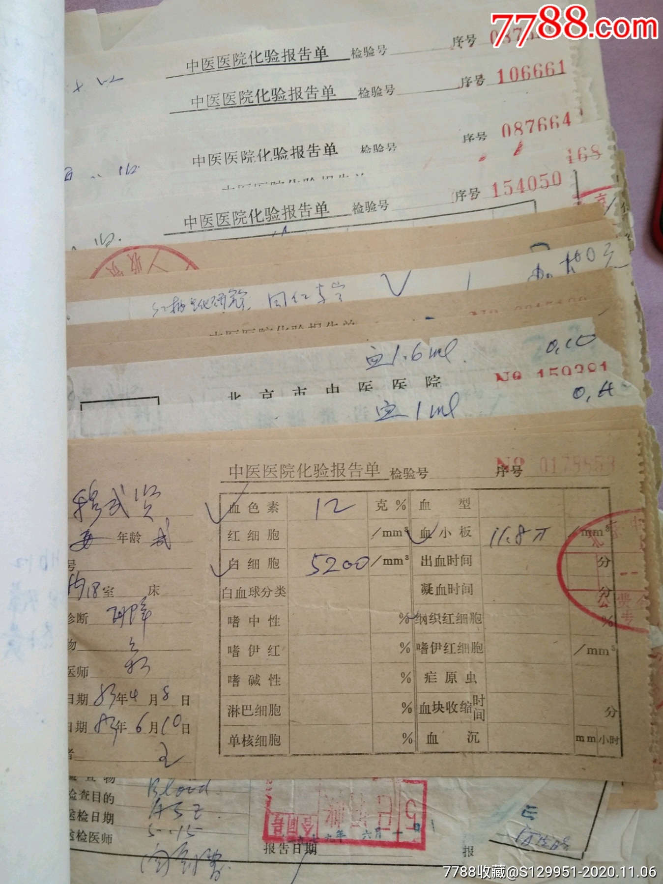 80年代北京中医院老中医病例处方多页(处方及化验单加起来有百余来页