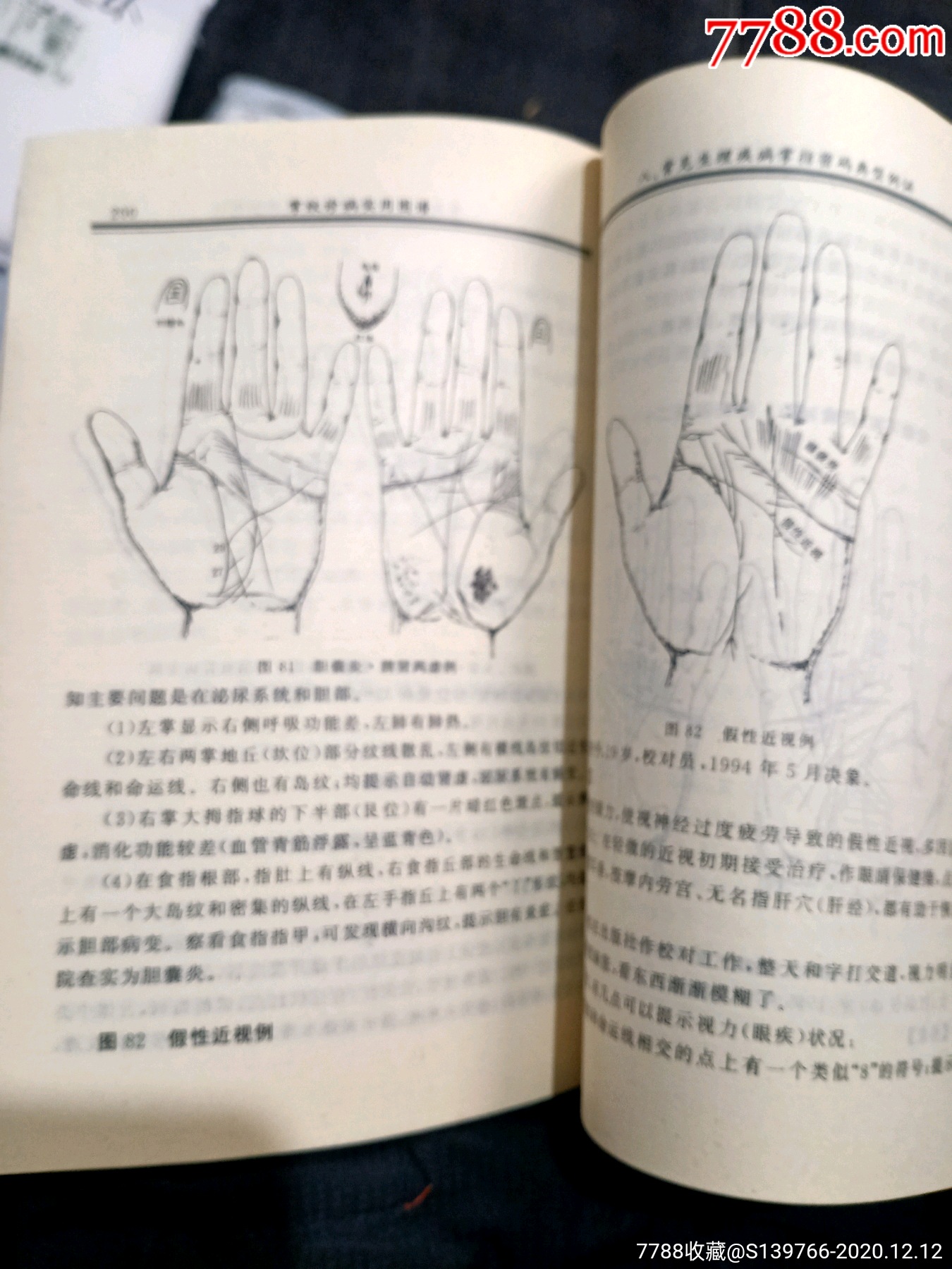 掌纹诊病实用图谱