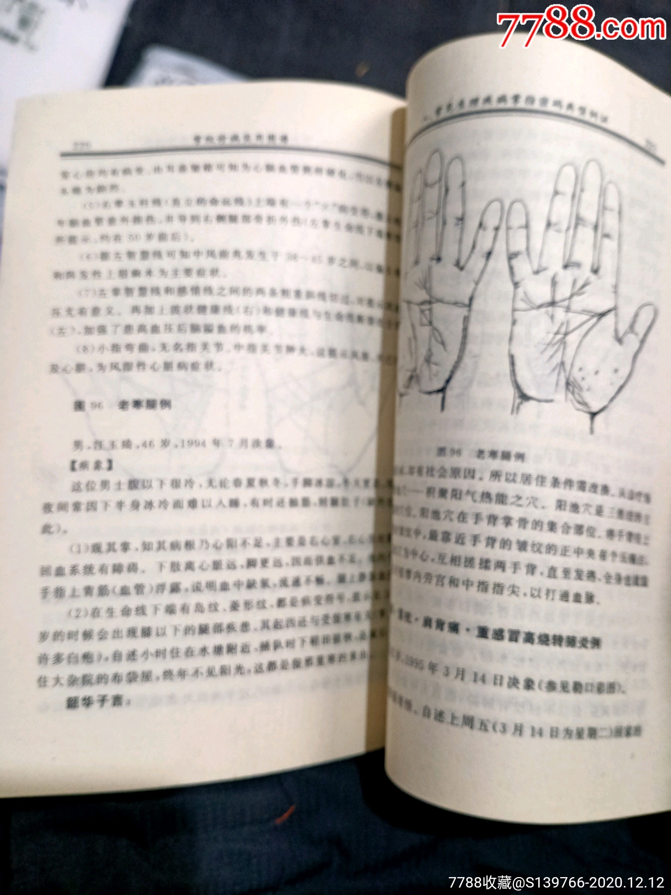 掌纹诊病实用图谱