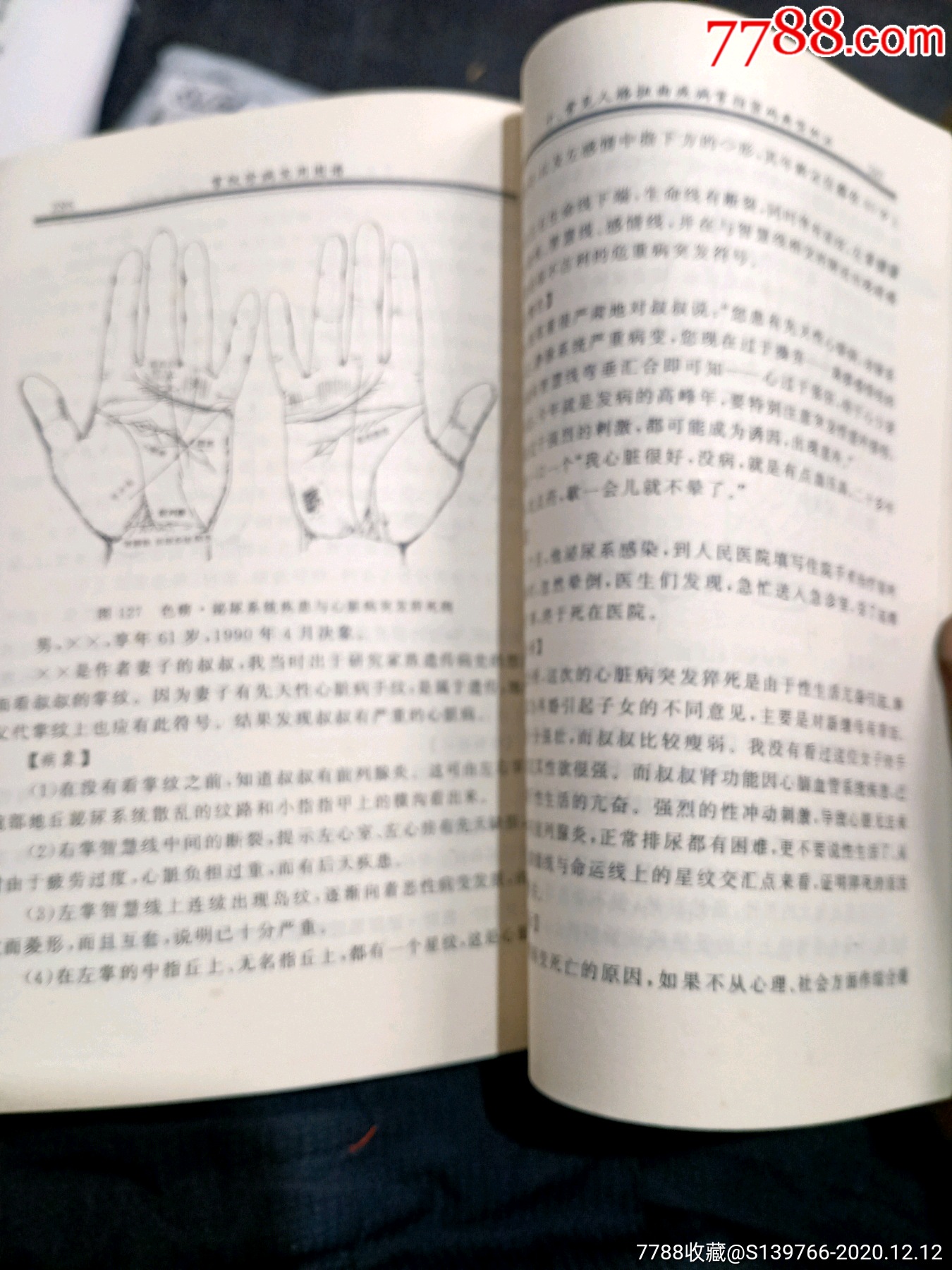 掌纹诊病实用图谱