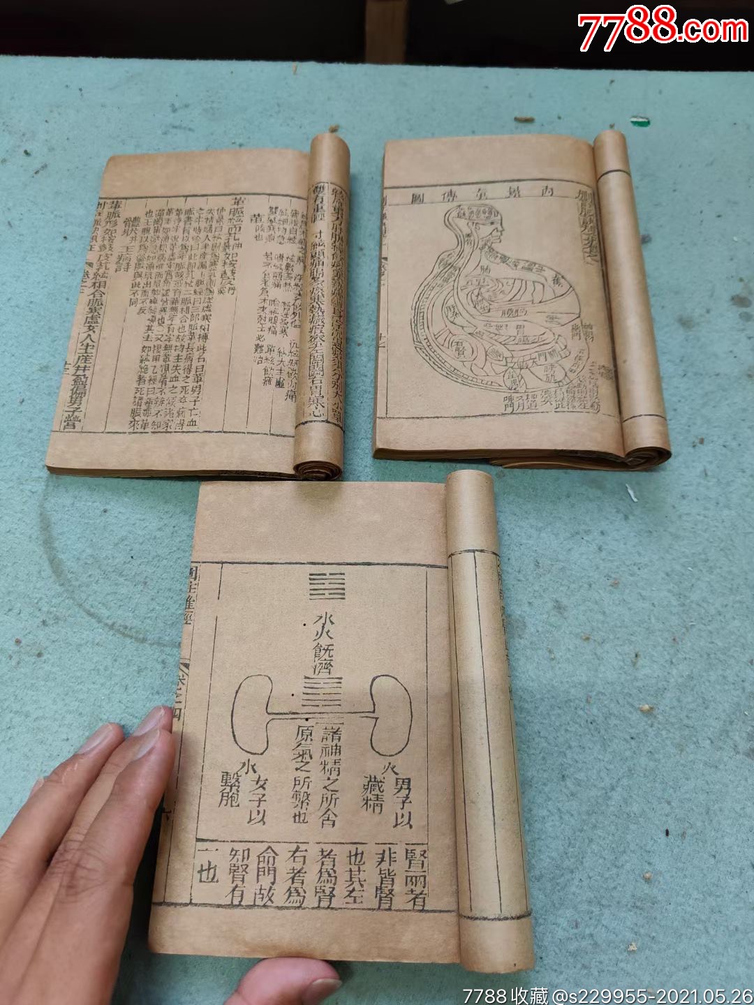 王叔和图注难经脉诀木刻版品相好一套四本缺卷三