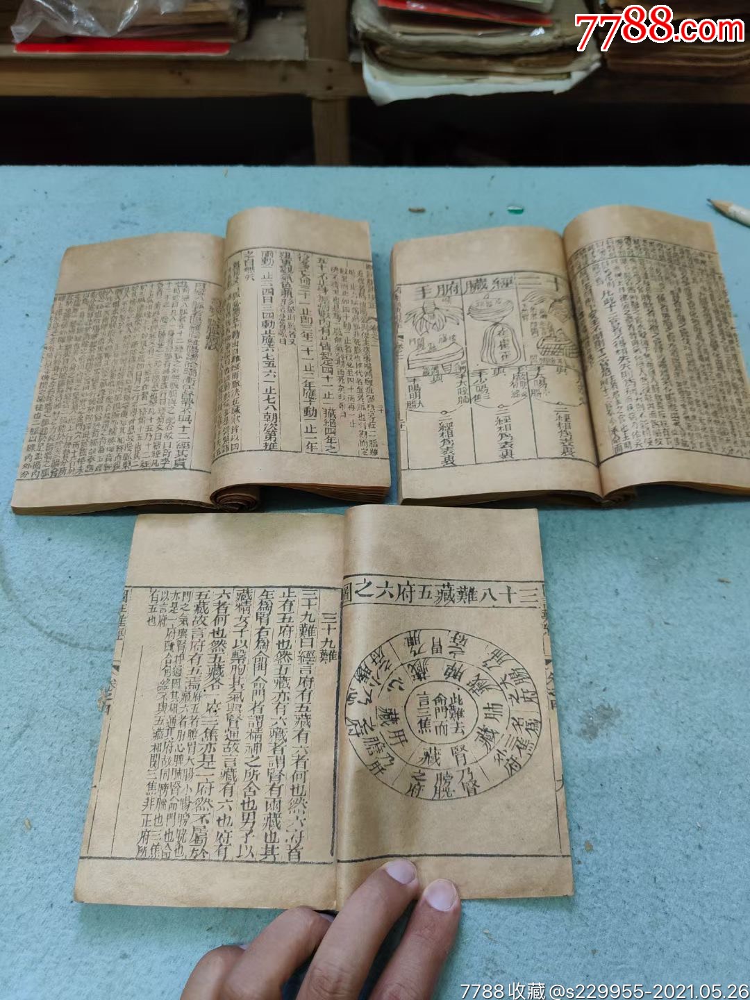 王叔和图注难经脉诀木刻版品相好一套四本缺卷三