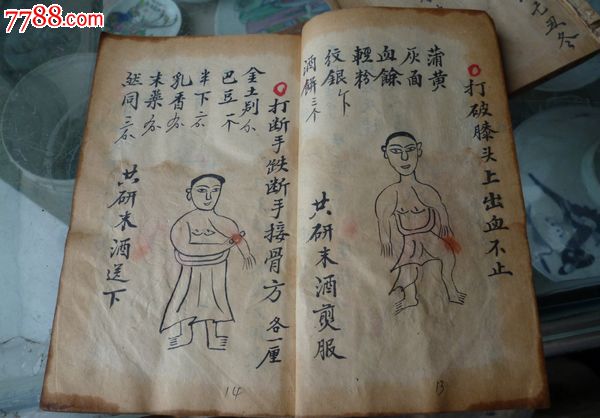 师传秘籍【人物图多多,带朱批.跌打损伤.血道.穴位秘书】(货号:142)