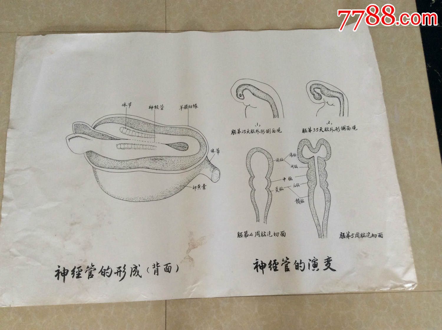 【医学原手稿】神经管的形成和神经管的演变【三号卷内】