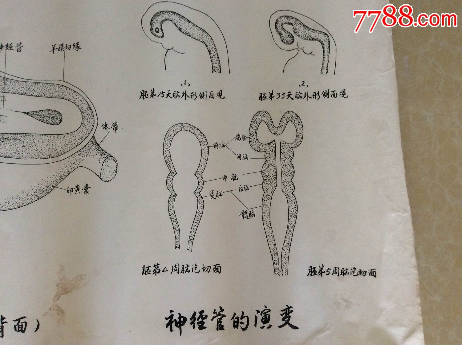 【医学原手稿】神经管的形成和神经管的演变【三号卷内】