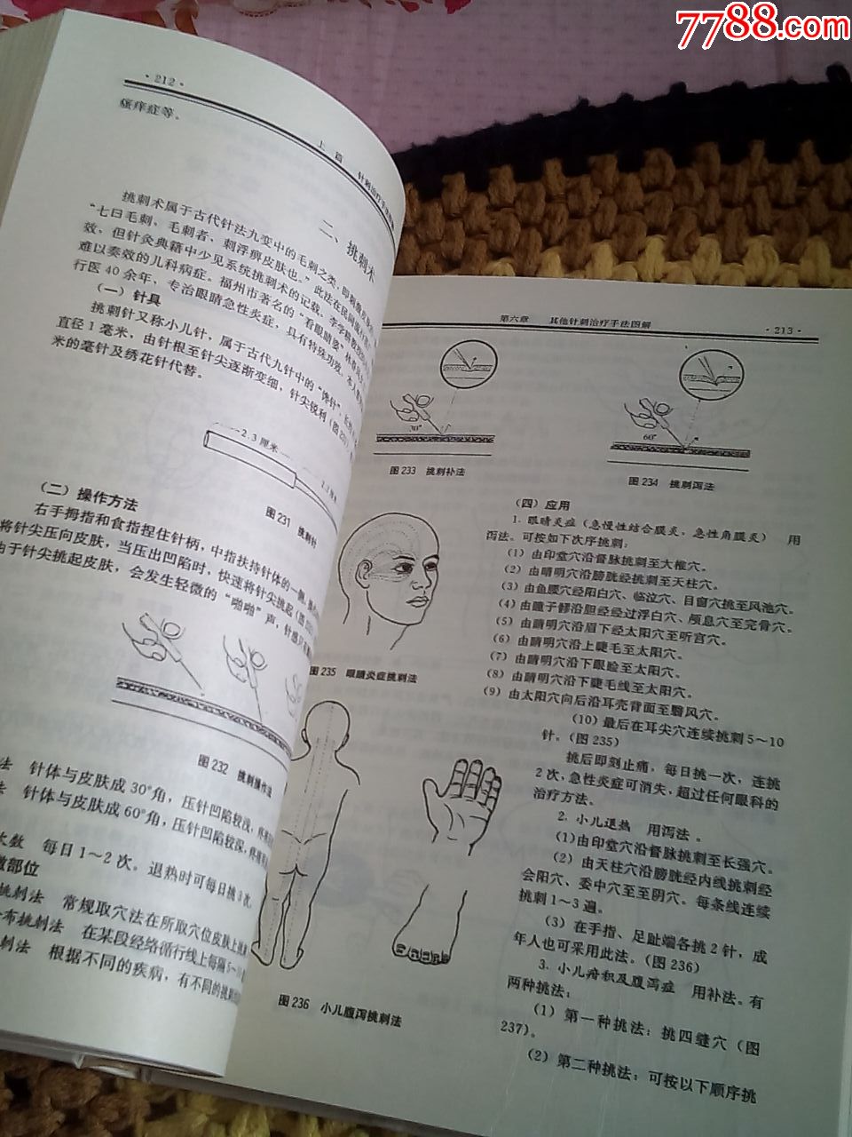 16开本《针法灸法图解》(精装本,是针灸师行针和进针的必备书,品严者