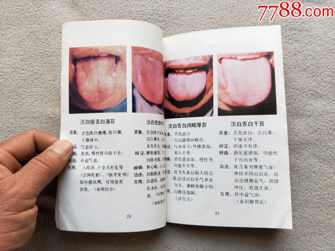 a1604,舌象诊断,长治市卫生局内*使用,发行少