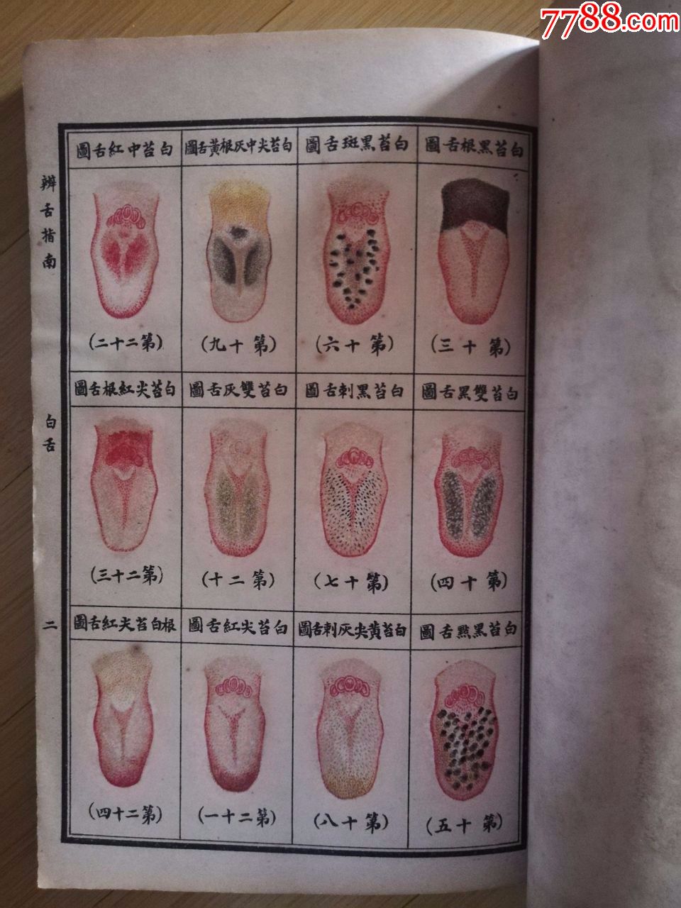 彩图辨舌指南_民国旧书_第13张_7788书籍