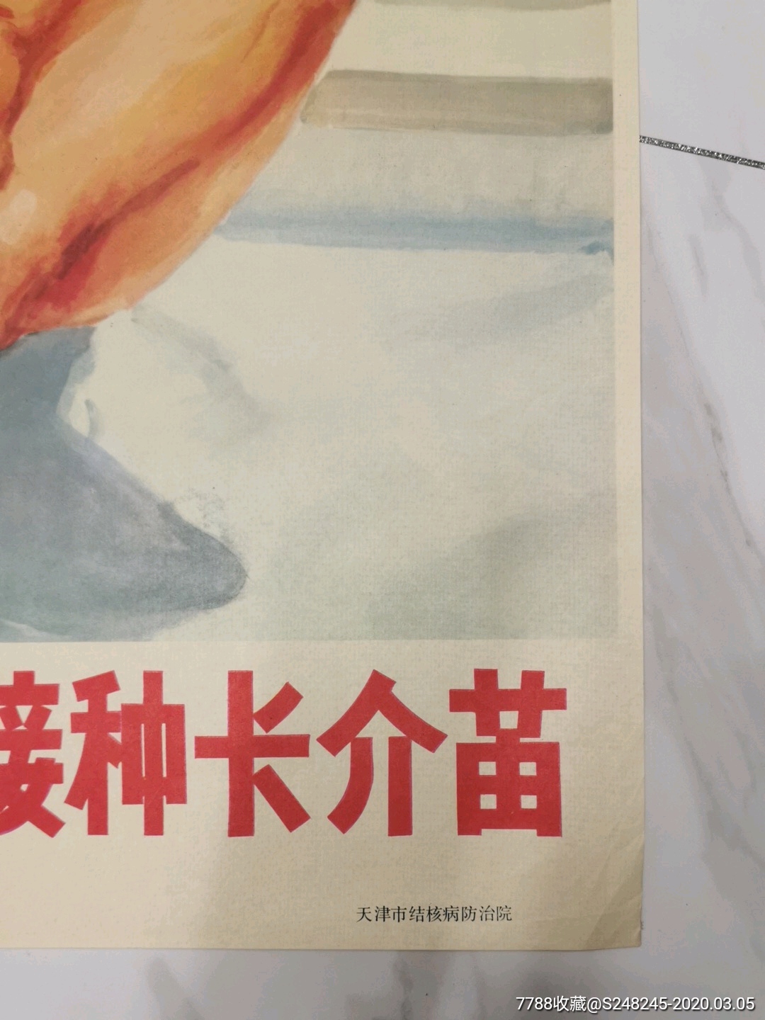 儿童要防痨接种卡介苗