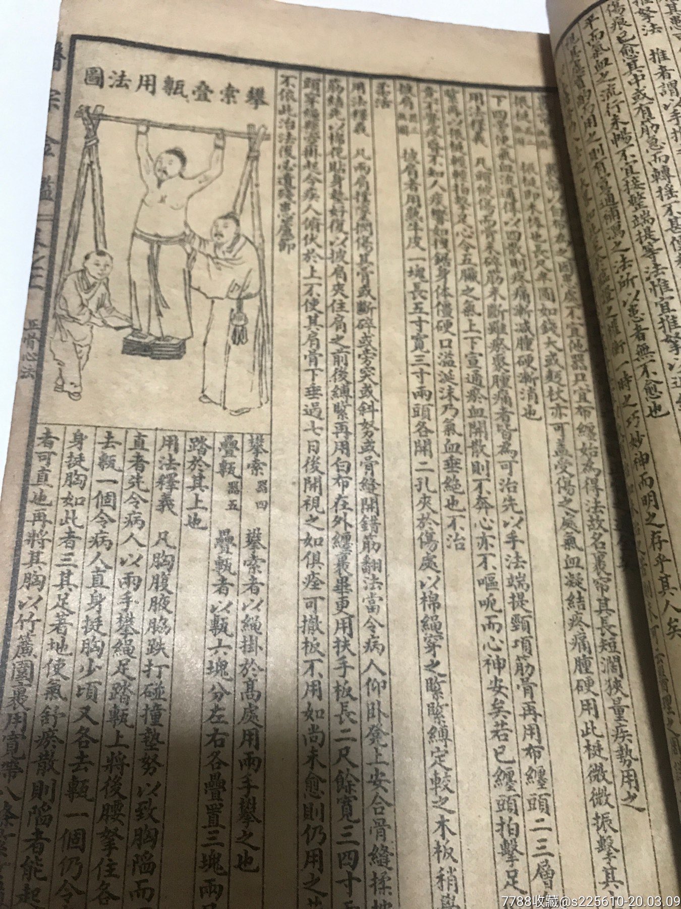 医宗金鉴之正骨心法,刺炙心法!古代医学精髓!古代人物治病图片多