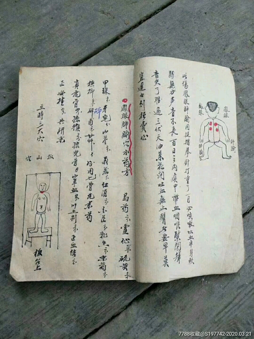 民国三十五年名医精录《祖传秘授跌打接骨秘本》一册全,出黑白复印件