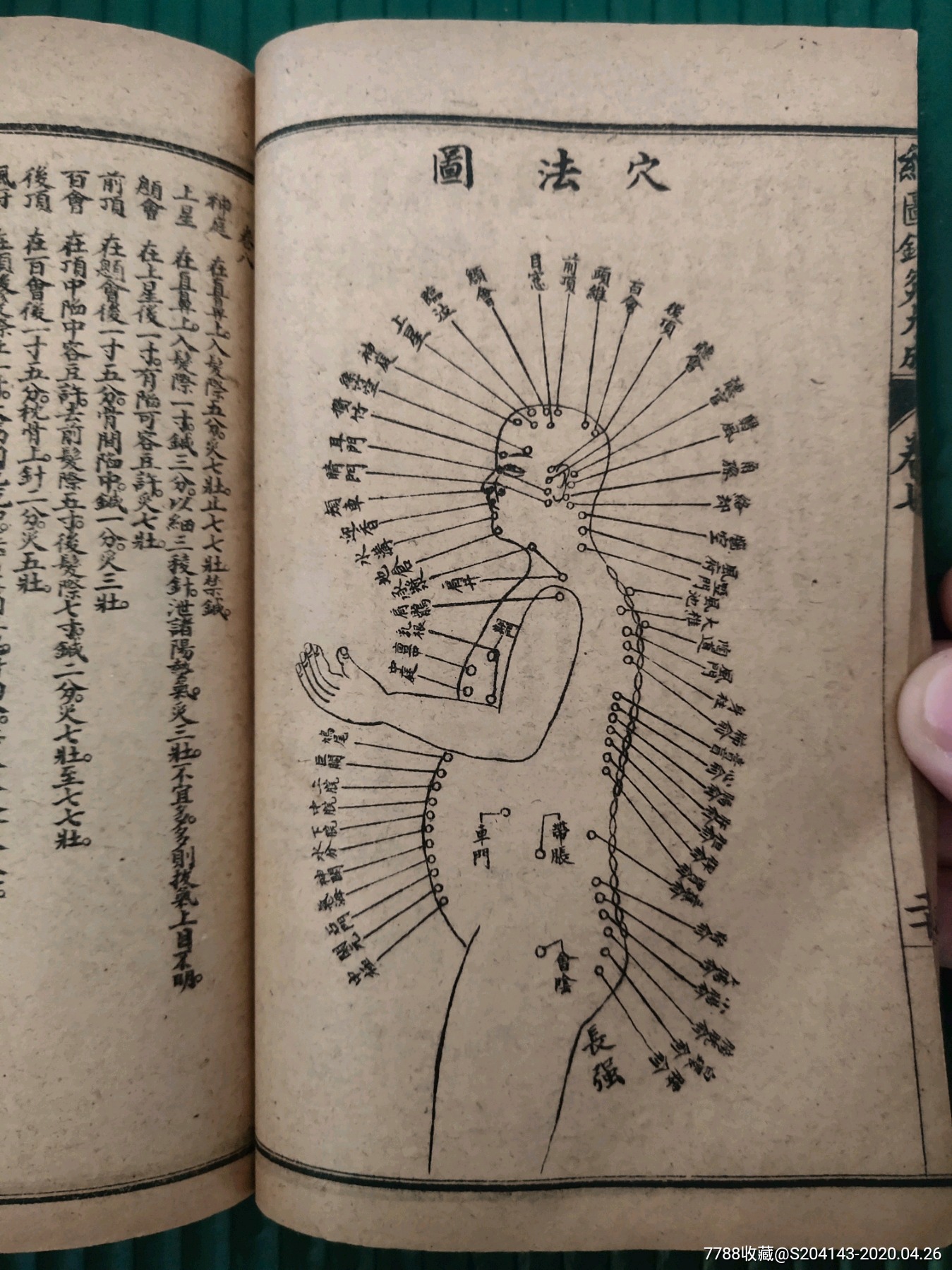 光绪年石印针灸大成一套共6册合订成三册10卷全杨继洲编著内有多图