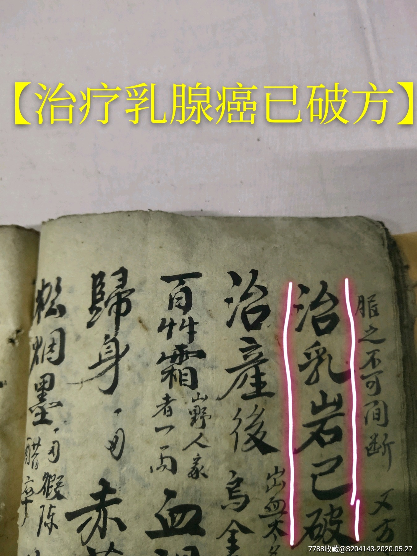 (特大手抄)清代醫書共67頁【治乳巖今乳腺癌秘方】【治療乳腺癌已破方