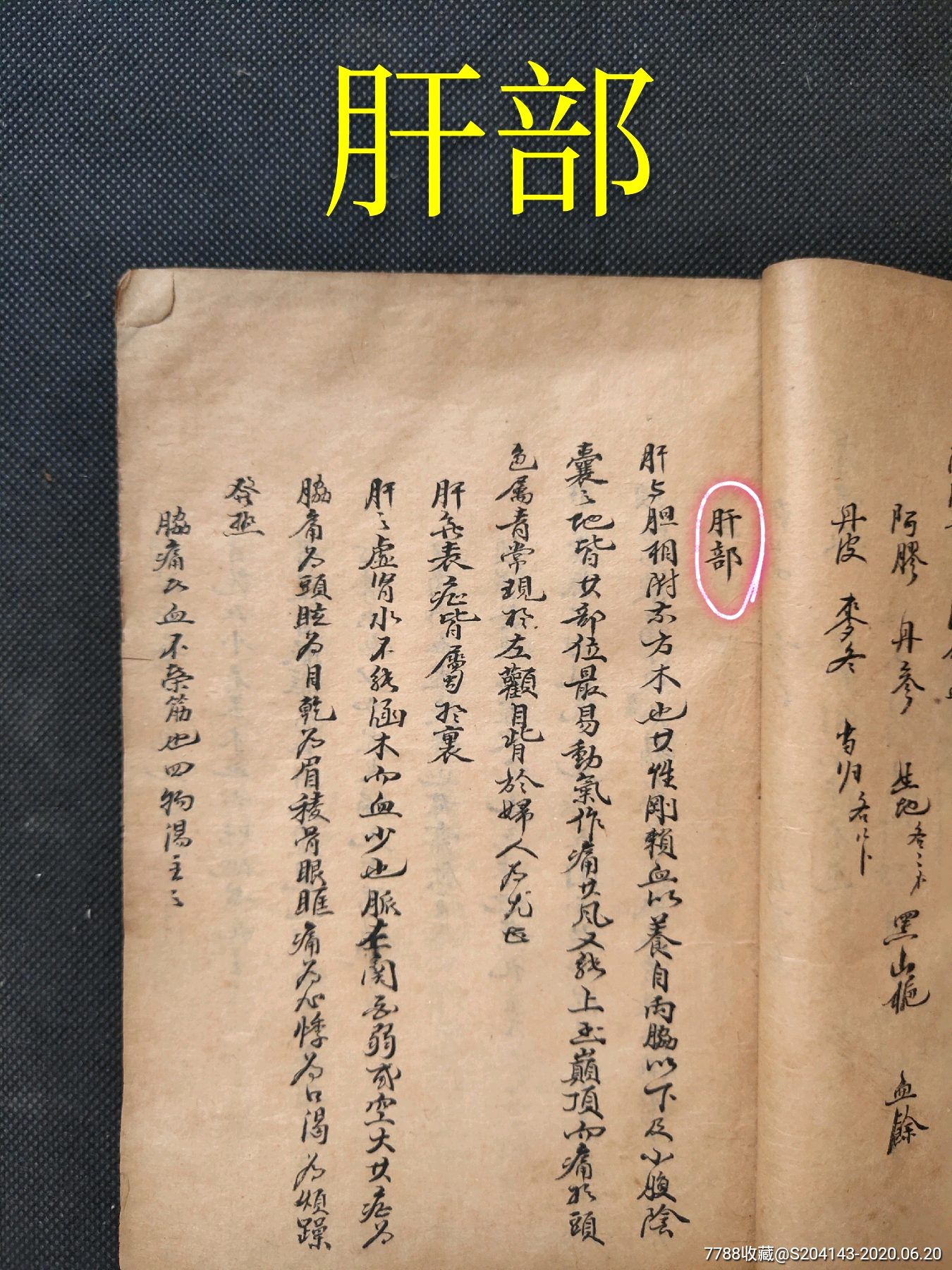 (特厚)(書法一流)清代手抄醫書(孤本)共146頁【治中風入髒熱?