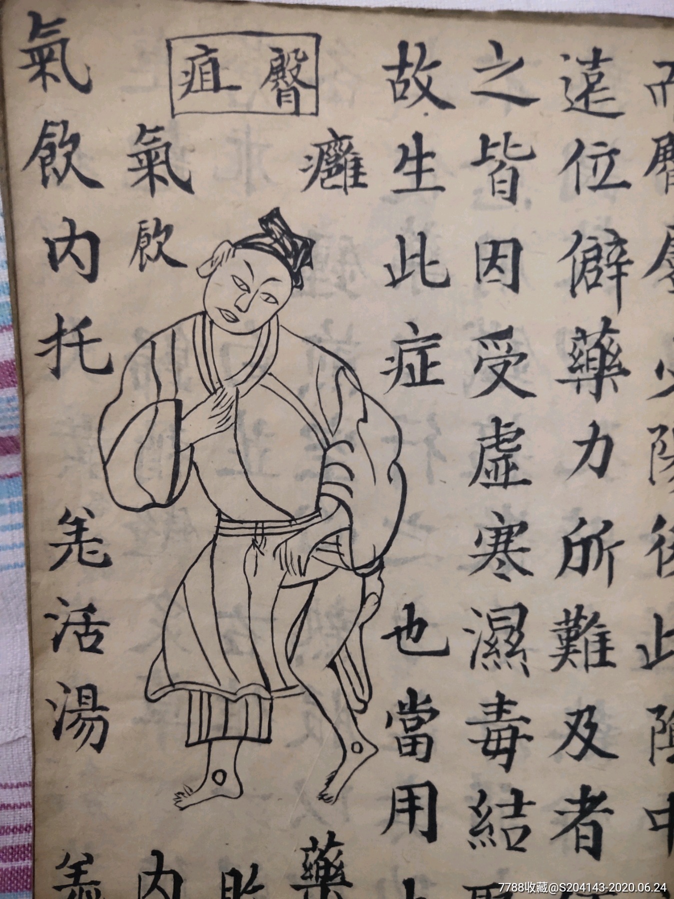 清代手抄医书秘方,共计65页,书法一流,手给人物图片21个.