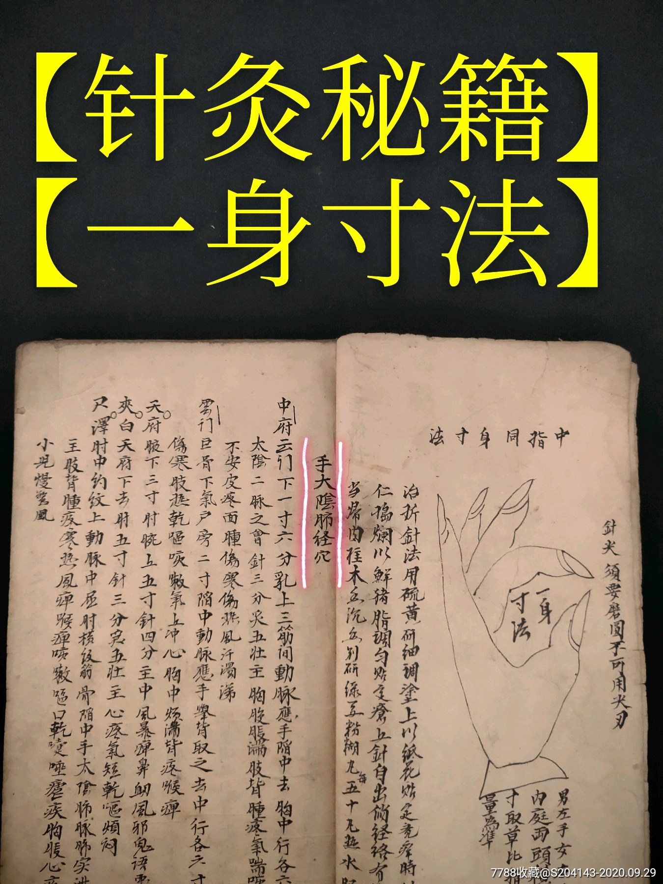 古代名医整理针灸秘籍孤品有自己独特的医学理论实践经验总结而成共7