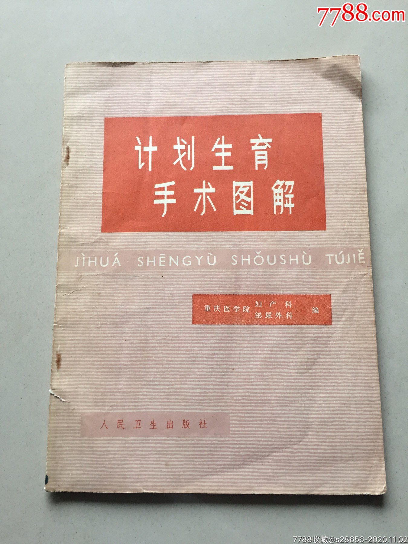 计划生育手术图解