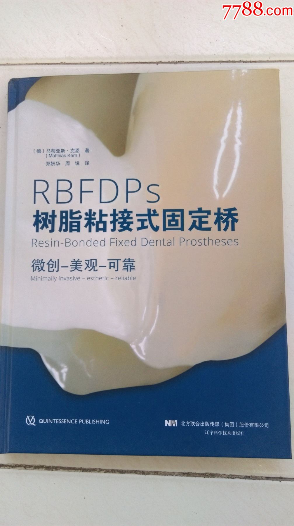 rbfdps树脂粘接式固定桥(微创—美观—可靠)