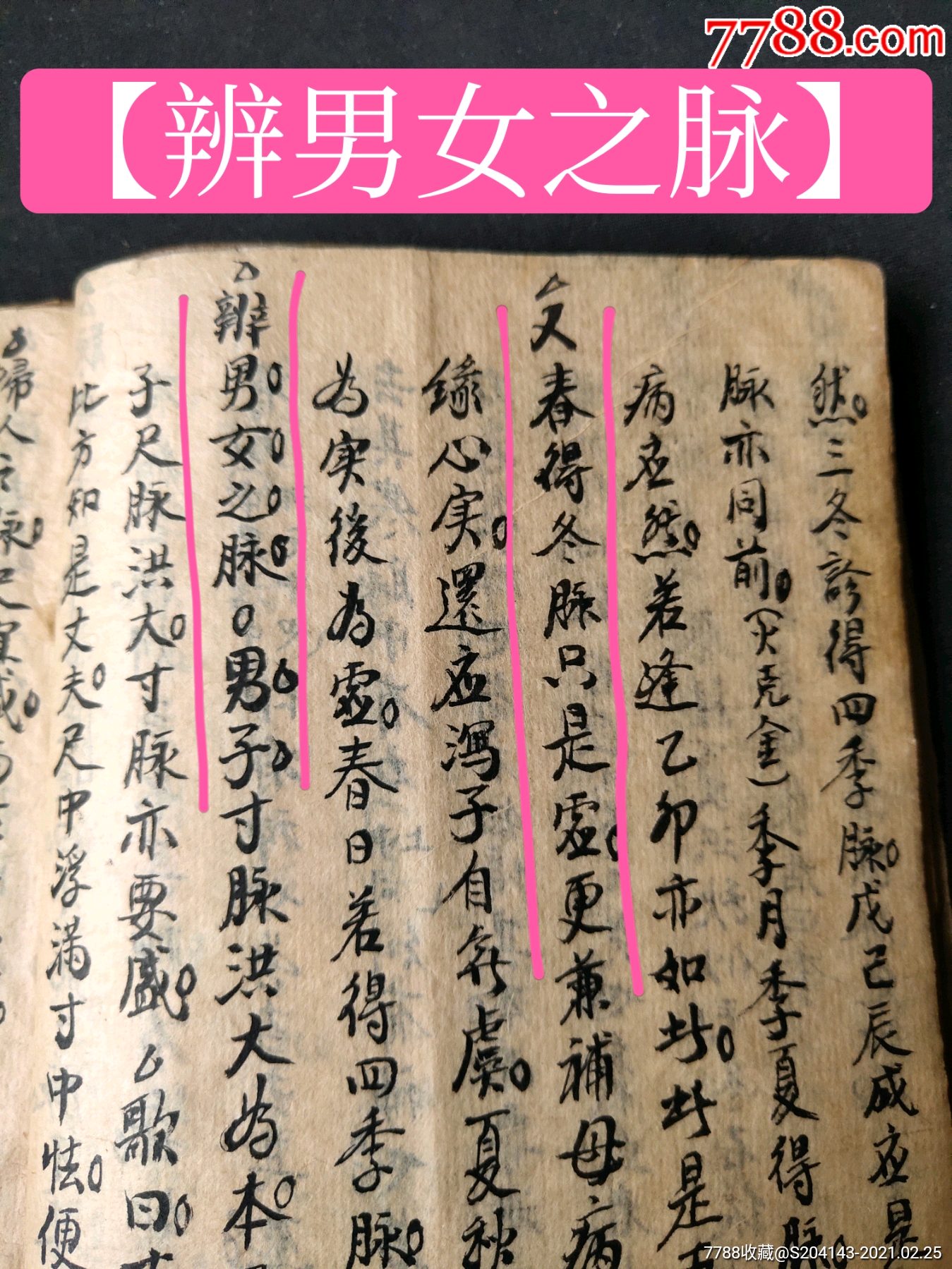 (脈訣文獻)清代精抄《診脈》(孤本)共75單頁【辨男女之脈】【求嗣之脈