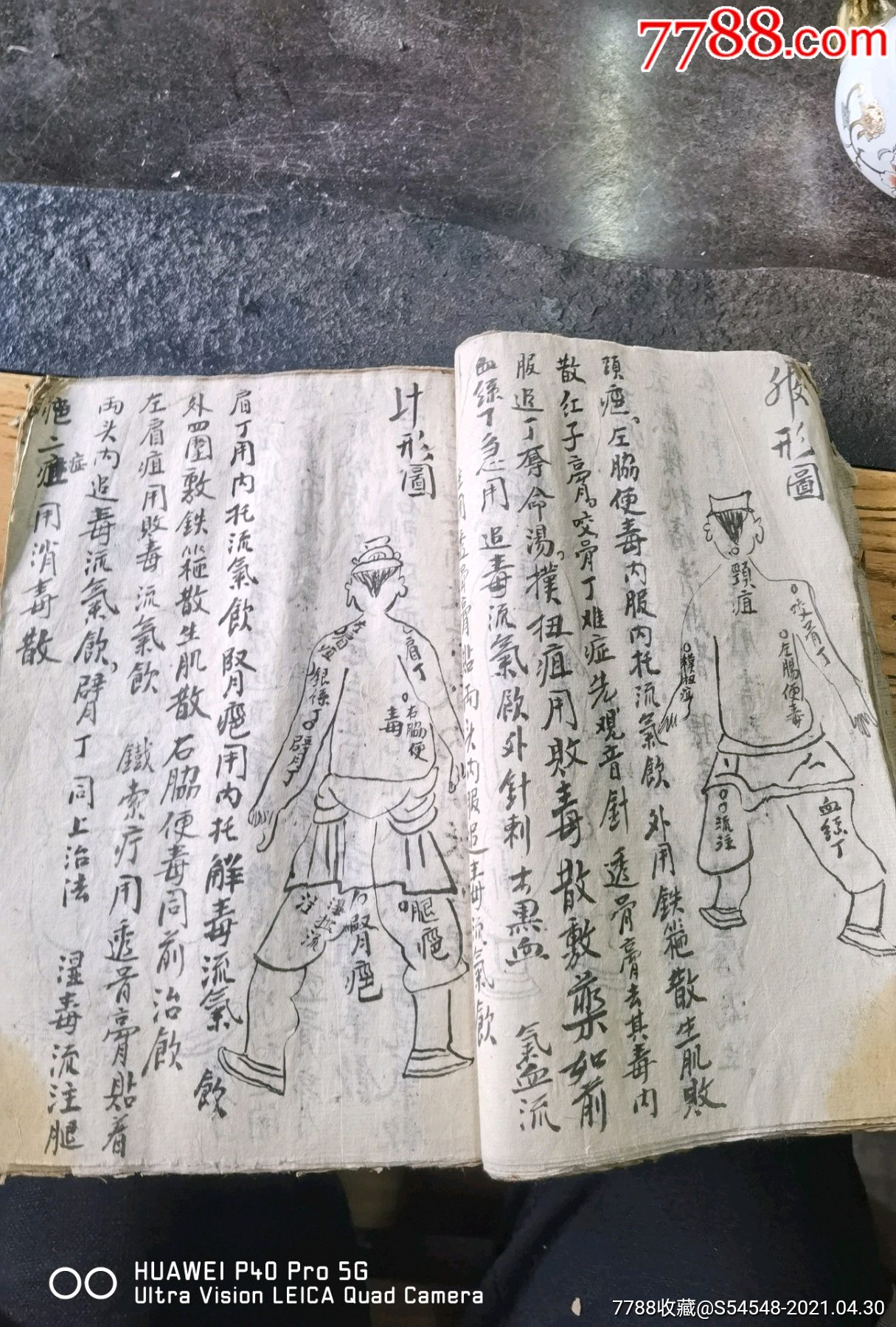 厚厚一本少见内容手写绘图名种疤疽沥瘿等少见疮毒病证治法药方齐全