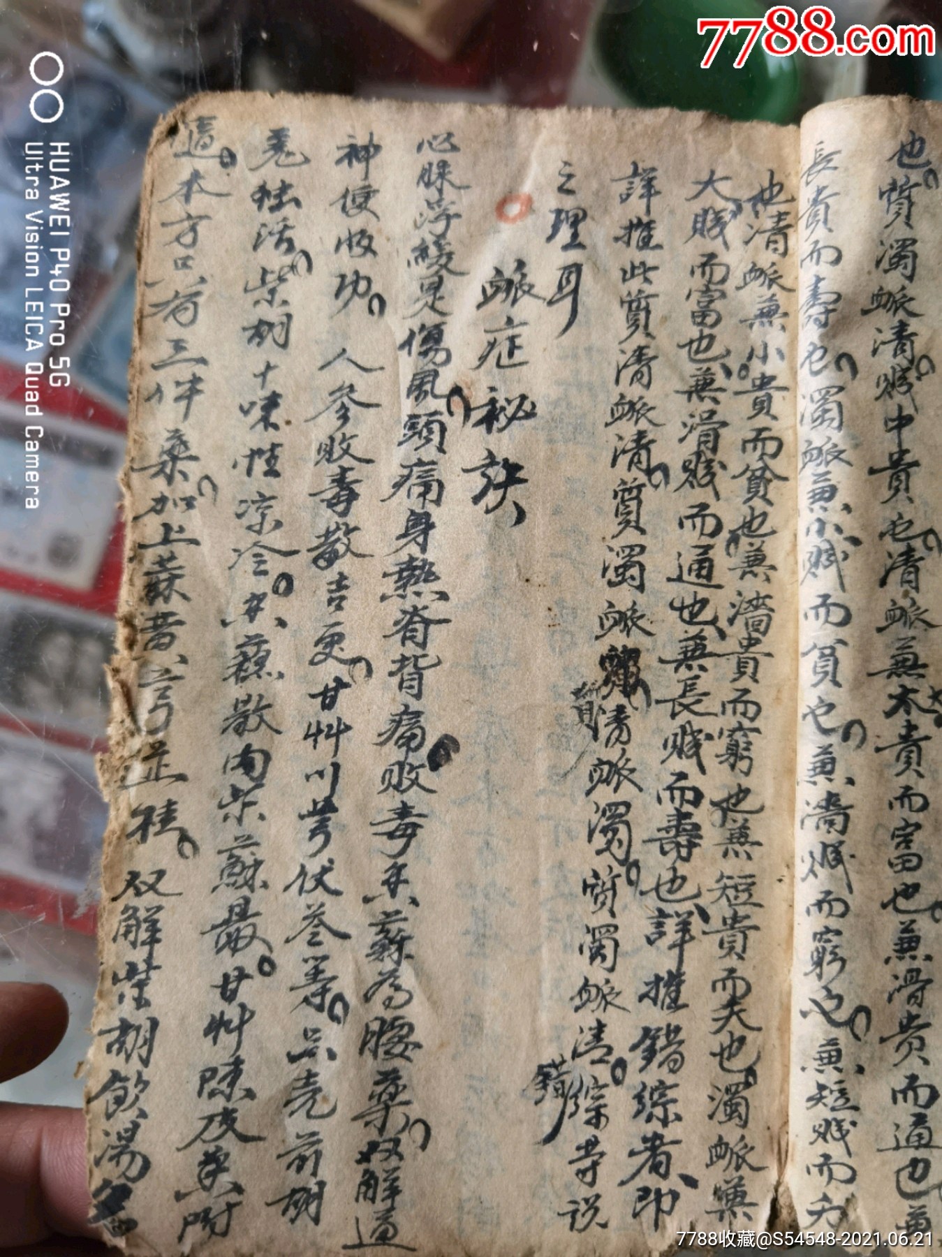 厚厚一本繪圖漂亮道光年手抄醫書,脈症秘訣,各種脈症後面有些各種藥方