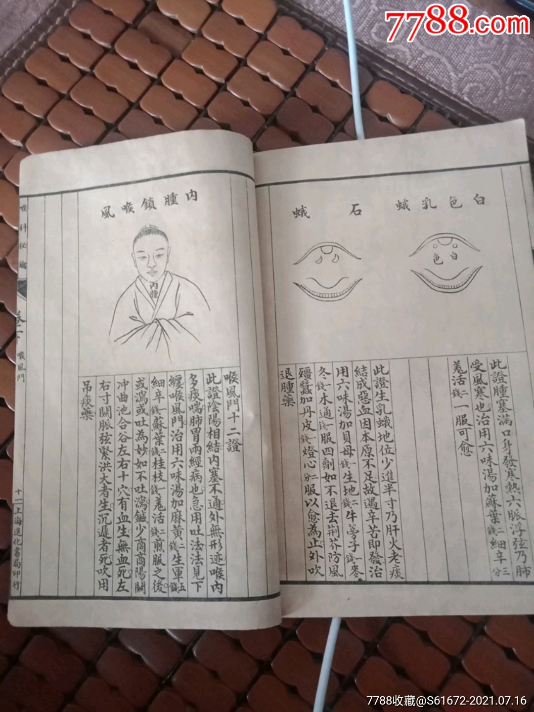 烂喉丹痧辑要,详图喉科秘钥【上面有2种藏书人的章】