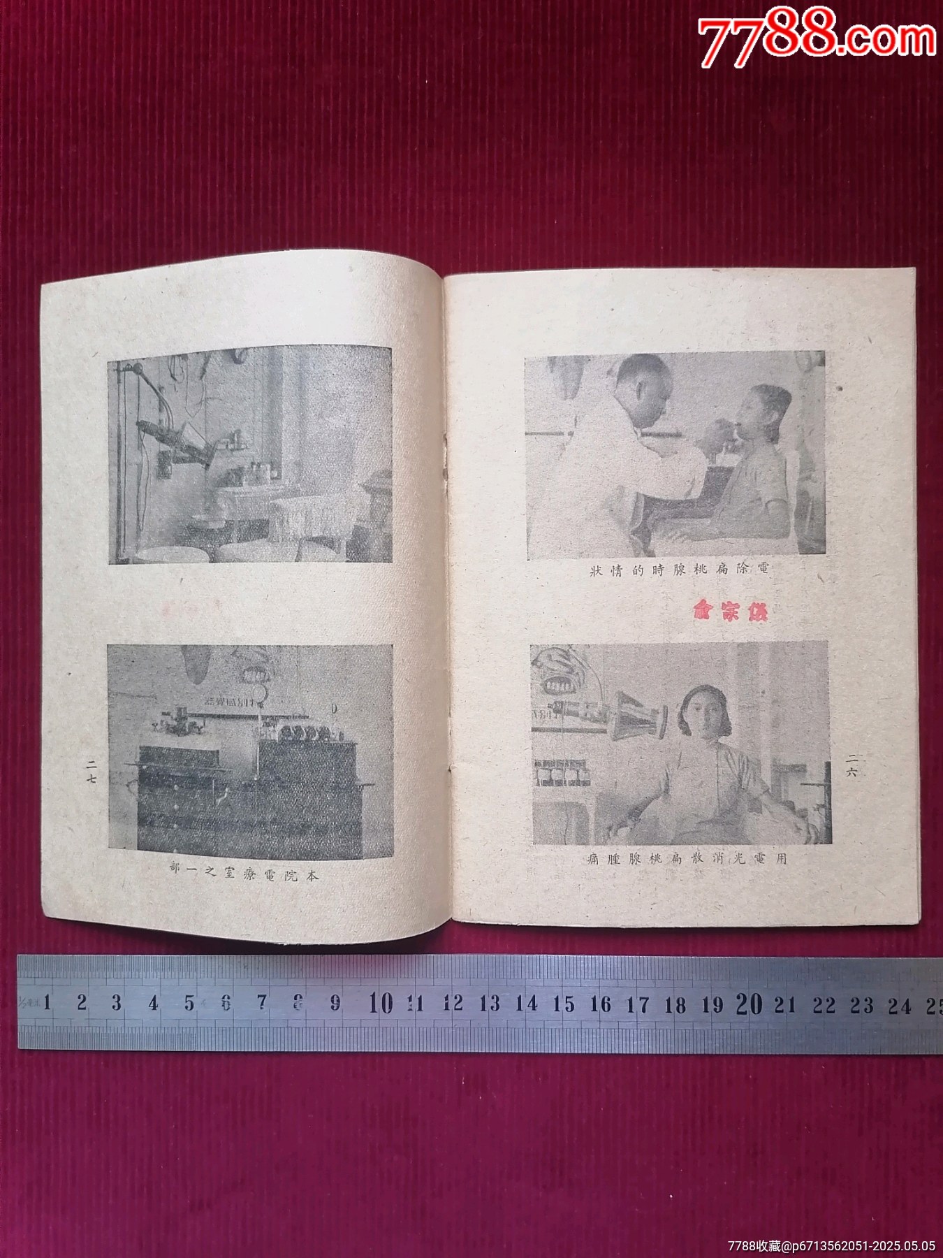 廣告：【最新扁桃腺電除法】_價(jià)格4999元【斯求之家】_第20張_7788收藏__收藏?zé)峋€