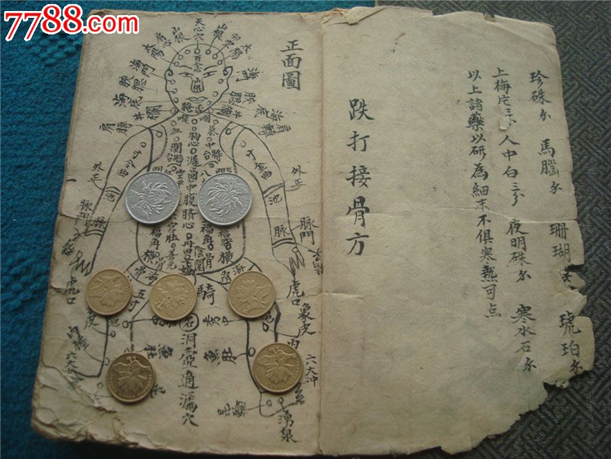 清代名家写绘稿本跌打接骨方图
