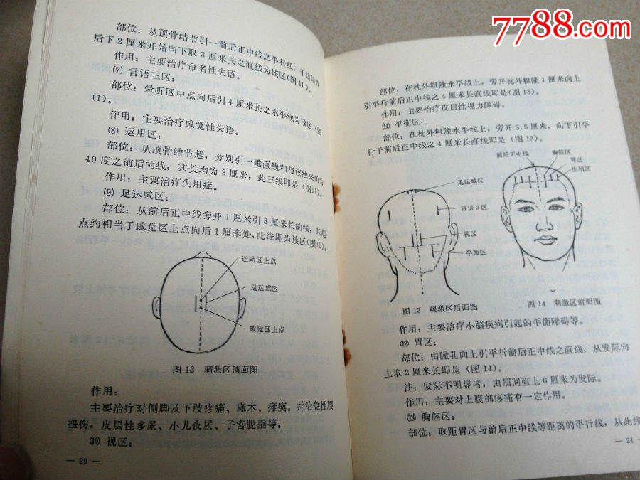 李氏杵针流派临床经验全图解$1209品99脐针入门$4009品99董氏奇穴