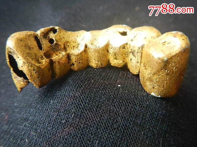 一组清民老金牙